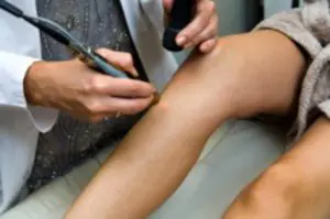 Varicose Vein Treatment | Glenn Dale MD Varicose Vein Treatment | Glenn Dale MD