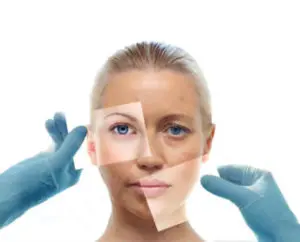 facial rejuvenation | glenn dale md facial rejuvenation | glenn dale md