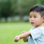 Infant’s Eczema Glenn Dale MD | Dr. Valerie Callender