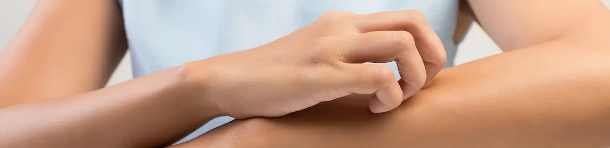 Psoriasis Glenn Dale MD Psoriasis Glenn Dale MD