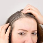 Hair Loss Glenn Dale MD