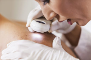 Female dermatologist (30s) examining male patient's skin with dermascope, carefully looking at a mole for signs of skin cancer.